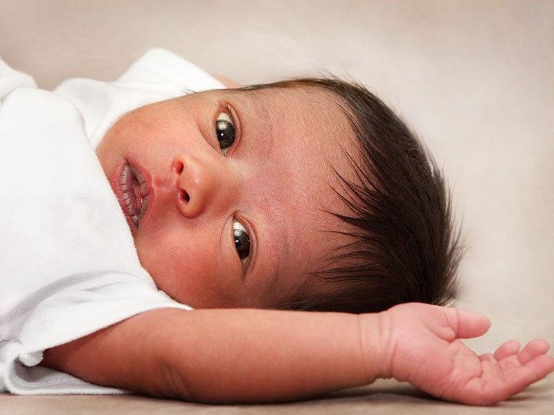 Cradle Cap and your little one - Babysense